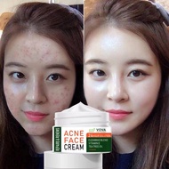 VOVA ACNE FACE CREAM acne treatment acne treatment acne remover blackhead remover acne scar remover
