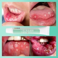 Ubat ulser mulut Mouth ulcer gel Oral ulcer gel 20g Repairing the oral mucosa Oral inflammation Brok