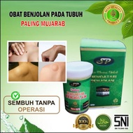 ( TERLARIS ) SALEP KHUSUS BENJOLAN AR-RAIHAN - MENGOBATI BENJOLAN - GONDOK - TUMOR  obat kista  benjolan kista Qahira minyak Qahira salep benjolan lipoma salep untuk mengatasi benjolan lipoma salep terbaik