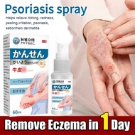 Ubat gatal Ubat kurap Psoriasis spray Ubat eczema Antibacterial Spray Quick Anti Itch Eczema Relief 