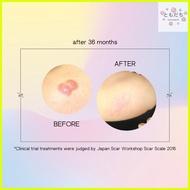 ╰ ☀ ✒ 10 Sheets of Eclar Plaster Japanese Keloid Scar Remover