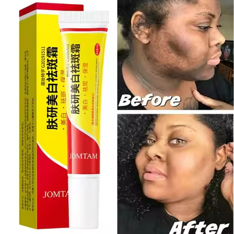 Face Brightening Cream Niacinamide Reduce Chloasma Melasma Melanin Fade Fine Lines Lighten Dark Skin