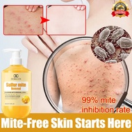 Acne body wash eczema body wash antibacterial body wash whitening body wash clearance body wash 硫磺沐浴