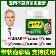 Symptoms of herpes zoster cream, snake sores, bile sores, snake sores, snake sores,带状疱疹膏后遗症蛇盘疮蛇胆疮缠蛇龙