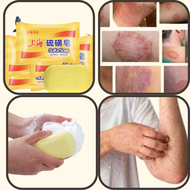 Sabun Shanghai Cina China Belerang Obat Gatal Kurap Kudis Eksim Kering dan Basah Area Selangkangan
