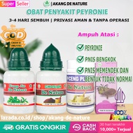Obat Untuk Penyakit Peyronie / Obat Pelurus -Penis Bengkok Ke Atas Samping 100% Alami | Obat Kemalua