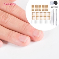 [Lohobby] Ingrown Toenail Correction Patch, Breathable Toenail Correction Stickers, Pedicure Tools
