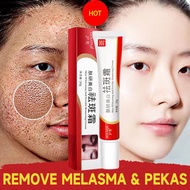 Melasma Remover Cream Whitening Freckle Cream  Remover Original Dark Spot Remover Ance Remover cream