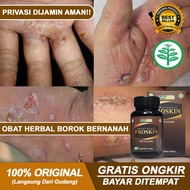 Proskin Kapsul Asli - Obat Borok Bernanah Budug Santri Gatal Scabies Gudik Koreng Bernanah Oba Gatal