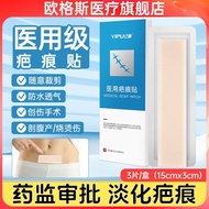 Ogus scar patch medical removal silicone gel caesarean section repair children's surgical hyperplasia