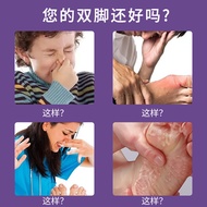 Genuine Athentic Athlete's Foot Cream Partial Foot Itching Foot Odor Cure Peeling Bad Foot Blister B