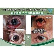 AiiVision Eye drop干眼 老化眼 红眼症 飞蚊症