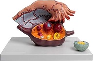 Human Female Reproductive Uterus Ovary Anatomy Model Gynecological Reproductive Teaching Aids Follic