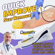 COD Stretch Mark Cream Scar Removal Cream Peklat Remover Acne Treatment Scar Remover Cream