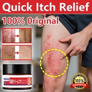 Steroid-free! eczema cream krim gatal kulit psoriasis cream 30g Eczema Itchy Peeling Dermatitis Herp