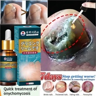 Nail Repair Essence Inhibit Fungal Nail Fungal Treatment Nail fungus