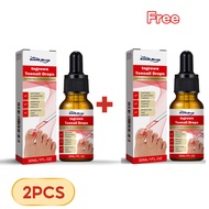 【Ready Stock】 South Moon Ingrown Feet Drops Repair Damaged Feet Strengthen Brittle Feet Restore Natu