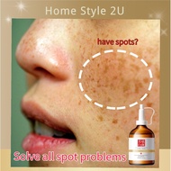 Krim jeragat Freckle cream Dark spot serum美白祛斑霜 Remove melanin whitening freckle cream