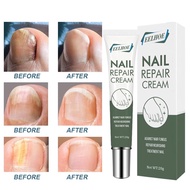 EELHOE NAIL REPAIR CREAM krim pembaikan kuku cantikkan kuku penghapus kulat kuku nail repair nail be