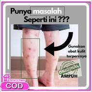 Obat Penghilang Bekas Luka Koreng Lama Hitam Di Kaki Anak Dan Remaja Salep penghilang bekas luka kor