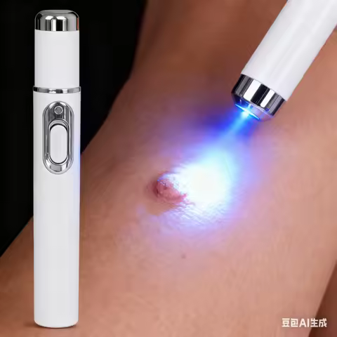 Blue light wart removal tools to make your life better.
