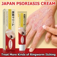 Salep Gatal Krim Gatal Kulit Herba Cina Ubat Gatal Celah Kangkang Anti Itching Antibacterial
