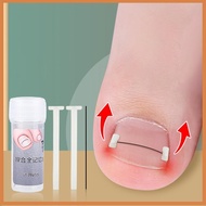 [WY2] Ingrown Toenail Corrector Tools Pedicure Recover Embed Toe Nail Treatment Ingrown Toenail Corr