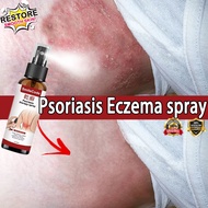 Japanese Psoriasis Eczema Antifungal Spray Anti-Itch Eczema Relief Skin Fungal Infection Treatment S