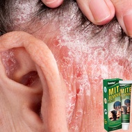 cream gatal kulit kepala Kelemumur Scalp treatment Folliculitis skintific foundation seborrheic derm