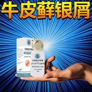 Cowhide Moss Silver Chips Moss Itching Cowhide Itching Dedicated Wet Itching Head Itching Hand Foot 