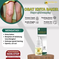 Benjolan Lutut, Kista Baker Benjolan Belakang Lutut Benjolan Di Belakang Lutut Kiri/Kanan ProPolis S