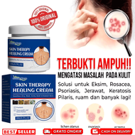 Salep gatal Salep Eksim Salep kulit Krim psoriasis paling ampuh Kulit Kepala Psoriasis Tangan Tinea 