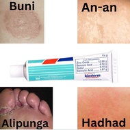 1104 Anti-fungal Cream Gamot sa An-an, Buni, Hadhad, Alipunga at iba pa 5g or 15g