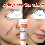 Scar Removal Cream Scar Gel stretch mark cream scar treatment hilangkan parut jerawat ubat jerawat d