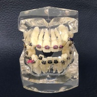 Mẫu hàm tư vấn nha khoa mô hình tư vấn sâu răng cắm implant sâu răng