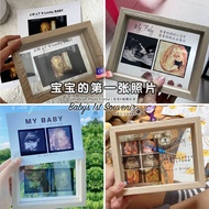 🔥 🇲🇾 LOCAL MADE🔥  Baby Ultrasound Scan Photo｜Customade Nursery Decor ｜Baby Gift ｜B超孕期照片