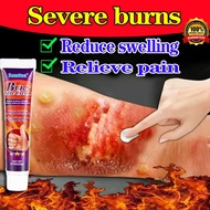 Burn Cream Scar Removal Cream Burn and Scald Care Ointment Krim Luka Bakar Suitable for scalds, burn