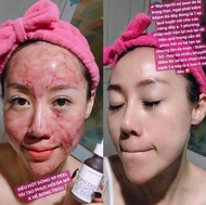 Tinh Chất Thay Da Sinh Học So’Natural Red Peel Tingle Serum