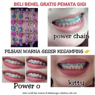 [GRATIS ONGKIR] Behel Lepas pasang // Behel Fashion Lepas Pasang //