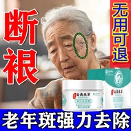 Freckle Cream Removing Melasma Age Spot Strong Removal Age Spot Removal Special Purpose Chemicals Elderly Black Class Face Removal 老人斑 祛斑霜