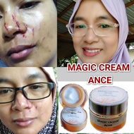 krim parut magic cream scar ance Original