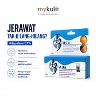 T3 Adapalene Gel 0.1% Untuk Jerawat Whiteheads Blackheads & Pori Tersumbat