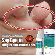 foot deodorant antibacterial spray ubat kaki berbau foot spray anti smell ubat kulat air kaki foot t