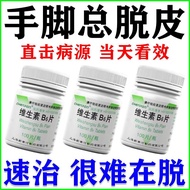 Medicine for peeling hands and feet [Lack of Vitamin B6] Sea治手脚脱皮药【缺乏维生素B6】季节性手脱皮皮肤粗糙干燥脱屑12.17
