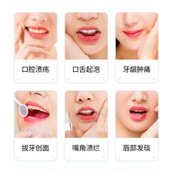 Sunflower Oral Ulcer Gel Fire Foaming Ulcer Oral Care Medical Dressing Ointment Mechanical Font Size