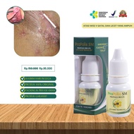Obat Miss V Lecet Gatal Miss V Becek Miss V Sariawan Keputihan Bernanah Miss V Bau Dan Sakit/Nyeri, 