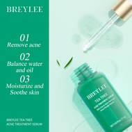 BREYLEE  Acne Treatment Serum Anti-Acne Scar Removal Cream Remove Acne Marks Essence Skin Care Acne 