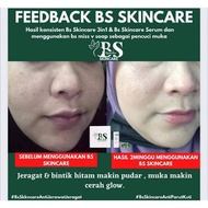 Bs skincare by faten aten free gift istimewa