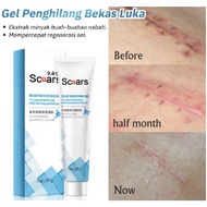 Scar cream scar cream scar removal cream CS
