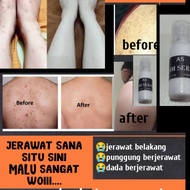 krim serasi,krim jerawat belakang,krim jerawat punggung,punggung menggerutu,kulit bontot kusam,bonto